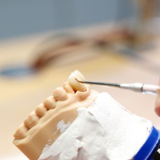 Zahnmedizinischer 3D-Drucker in der Zahnarztpraxis Dr. Gerstenkamp in Hann. Münden