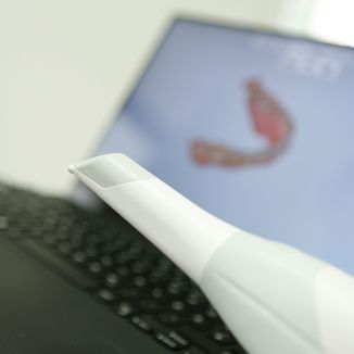 Intraoralscanner in der Zahnarztpraxis Dr. Gerstenkamp in Hann. Münden